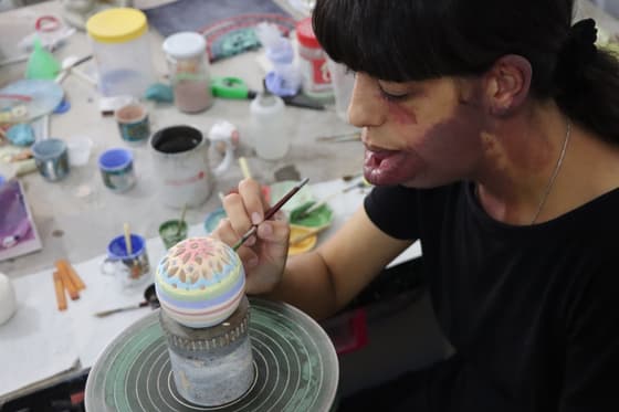 The story of Basma, between courage and passion