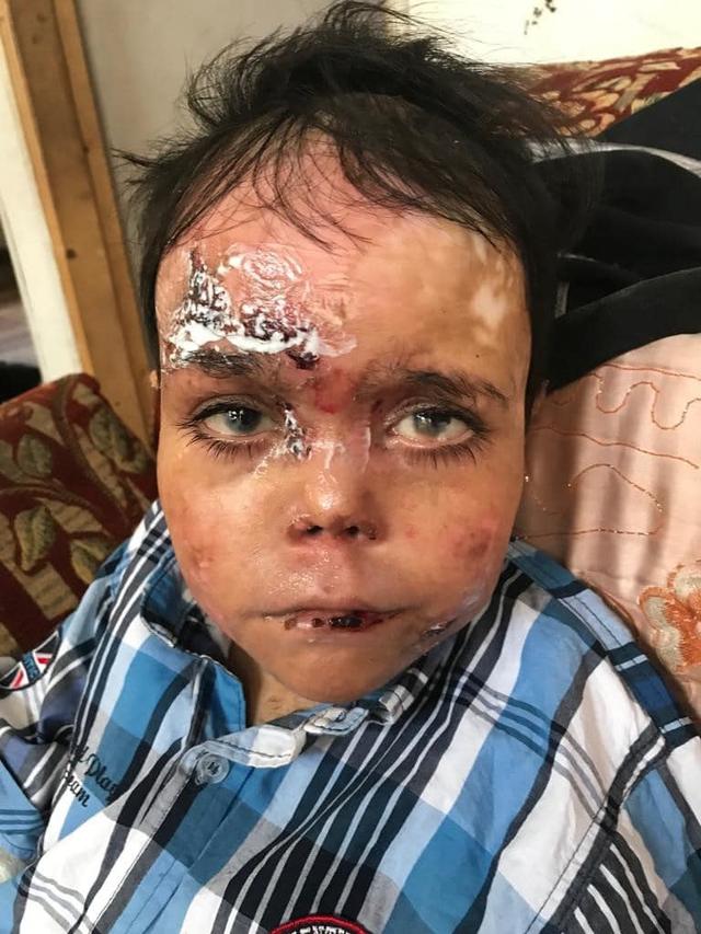 Sostegno ai bambini farfalla di Gaza